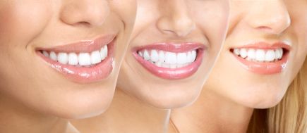 Bělení zubů doma je jeden z nejpohodlnějších a nejdostupnějších způsobů jak získat bílý úsměv. 