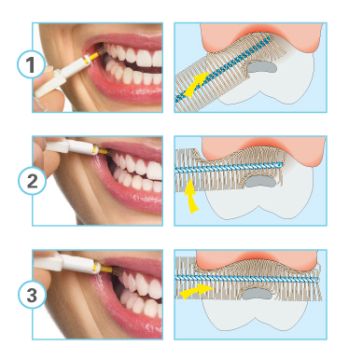 Jak používat mezizubní kartáček, aby byly vaše zuby zdravé.
