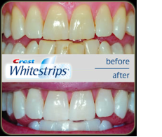 Bělicí pásky Crest obsahují stejné ingredience, jako používají zubaři při profesionálním bělení chrupu. Přečtěte si o tom, jak funguje bělení zubů s páskama Crest Whitestrips.