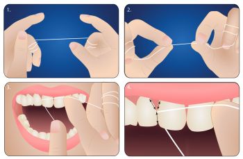 Správná technika použití zubní nitě vás ušetří od poranění a zajistí vám kvalitní odstranění zubního povlaku z mezizubních prostor.