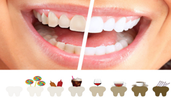 Určité typy potravin způsobují zabarvování zubů. Bílou dietou předejdete zabarvování zubů a bílý úsměv vám vydrží déle.